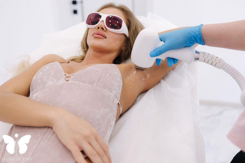 Laser Hair Removal