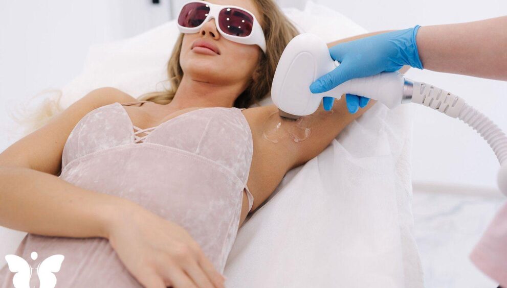 Laser Hair Removal