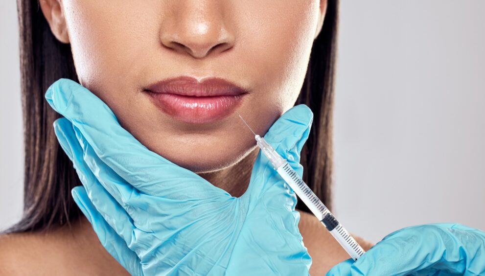 Juvederm Dermal Fillers