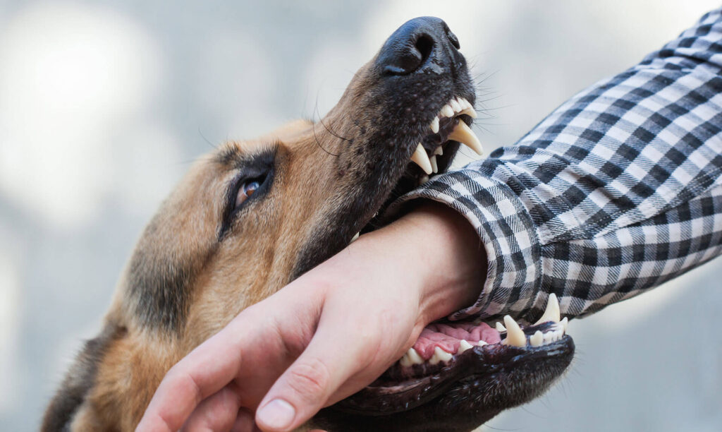 Skilled Dog Bite Lawyer