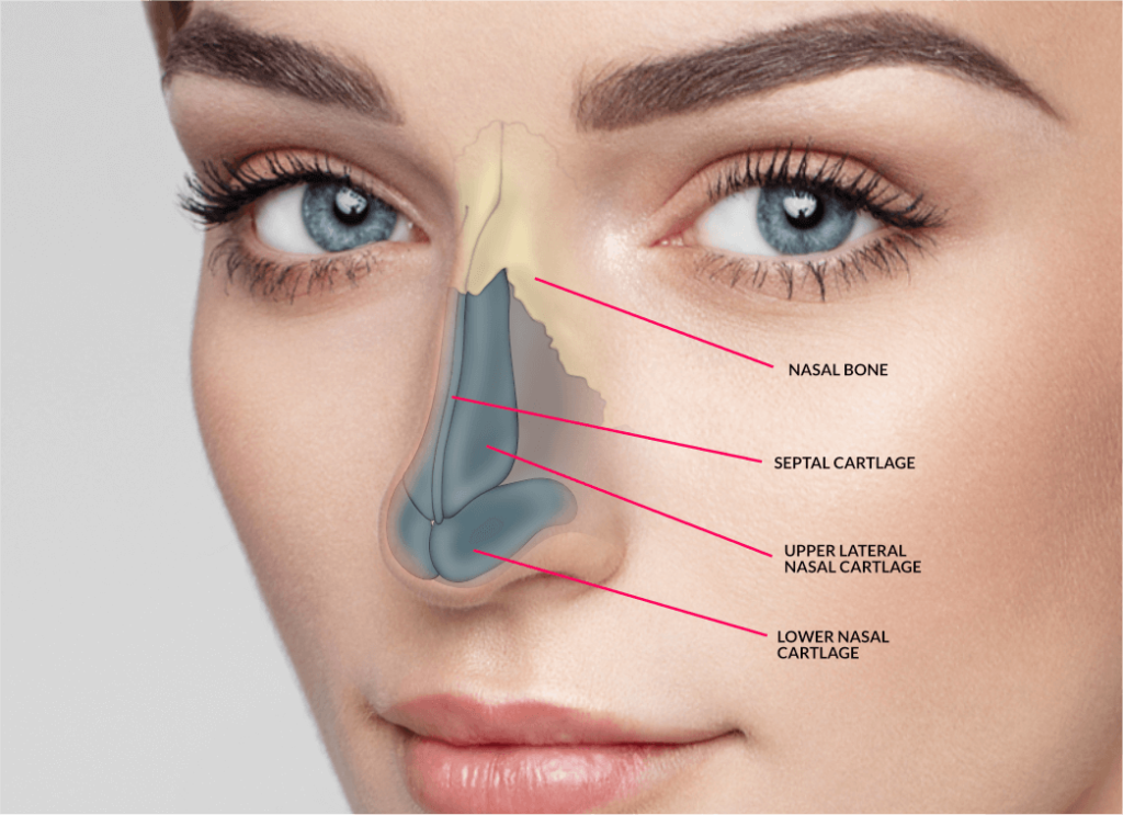 Rhinoplasty