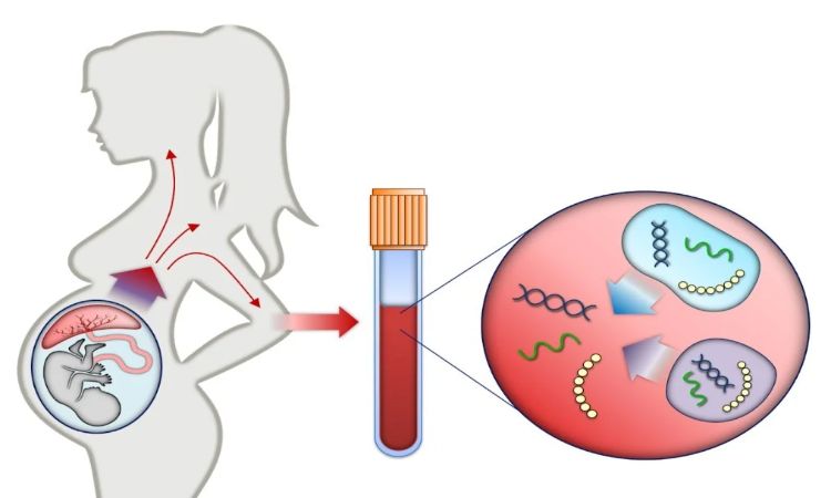 NIPT Test in Pregnancy