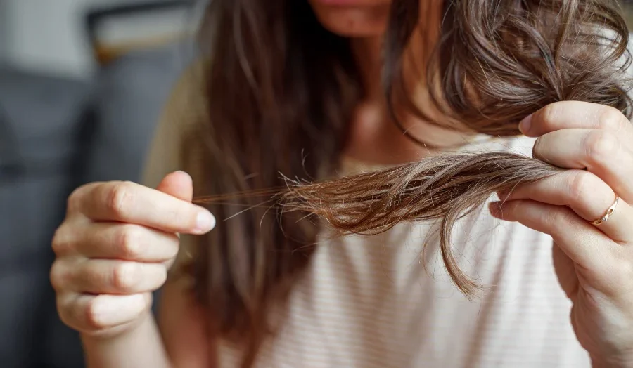Hair Is Falling Out