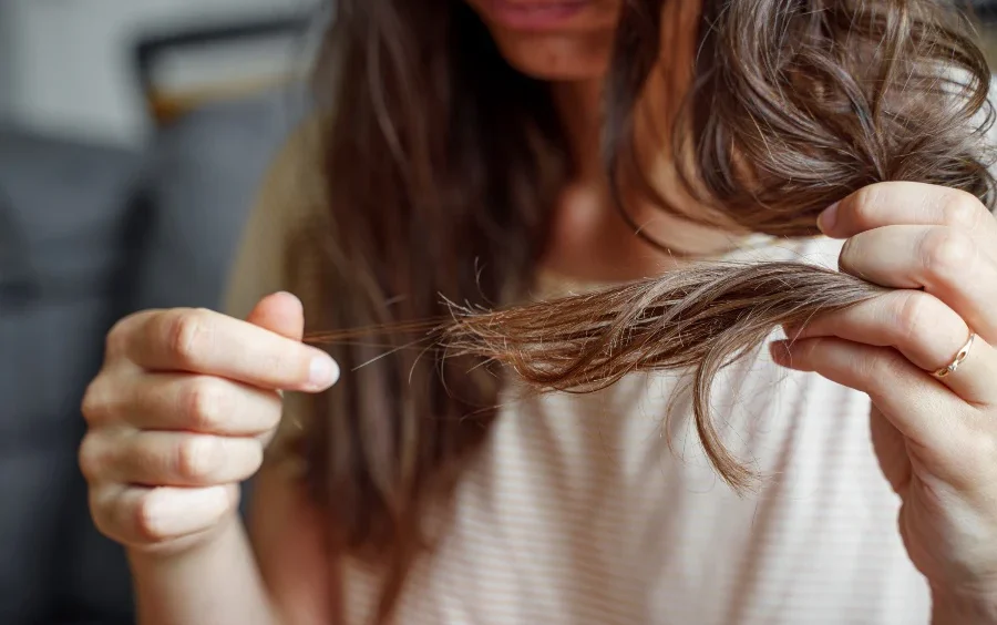 Hair Is Falling Out