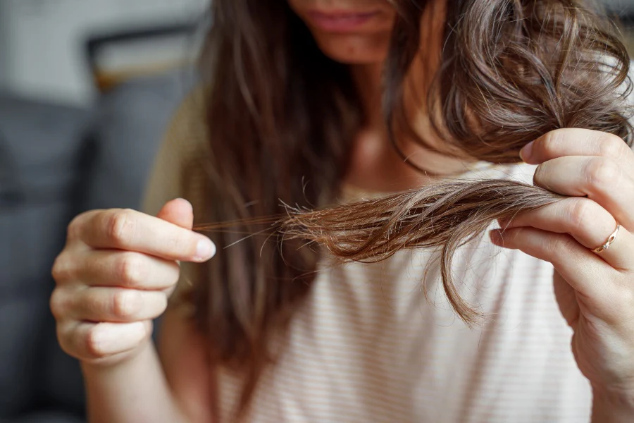 Hair Is Falling Out