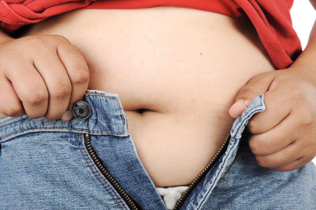 Abdominoplasty Surgery