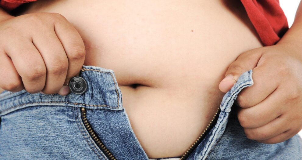 Abdominoplasty Surgery