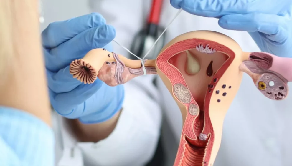 Tubal Reversal Surgery