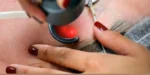 Chemical Peels in Phoenix: Benefits, Types, and What to Expect