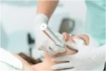 Book Now, Glow Later: The Best Time to Get Microneedling Before Holiday Photos