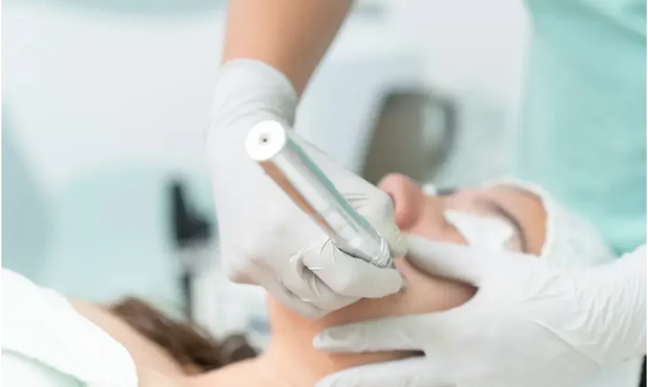 Microneedling
